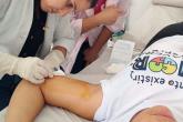 Com 5,9 mil inserções em 2026, Estado intensifica treinamento para implante contraceptivo